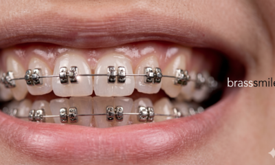 Brasssmile